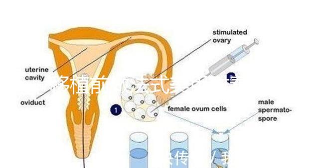 移植前做法式美甲對著床影響不少，別以為貼甲片就沒事了