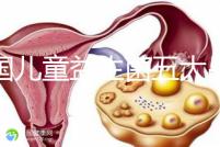 美國兒童益生菌五大品牌排行榜，康萃樂、家得路榜上有名