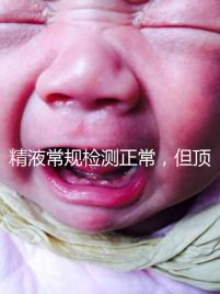 精液常規檢測正常，但頂體酶低，是否影響試管嬰兒成功率？