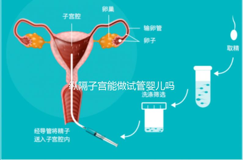 縱隔子宮能做試管嬰兒嗎?醫(yī)生:可以做，但要手術(shù)治療再進(jìn)周