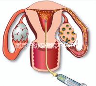 南京婦幼保健院不孕不育醫生排名匯總，掛哪個好一目了然