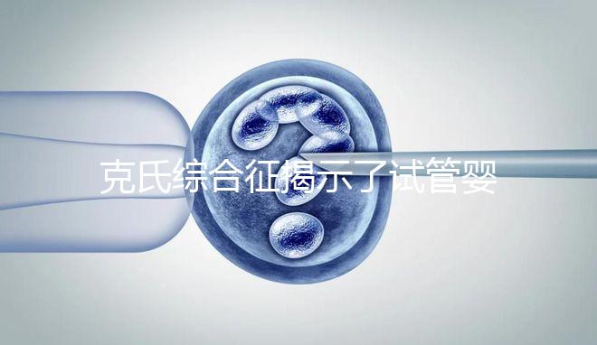 克氏綜合征揭示了試管嬰兒的最佳年齡大于這個(gè)年齡要注意