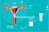 克魯宗會(huì)遺傳給后代解答嗎?他生來(lái)就有一篇清晰的文章嗎?