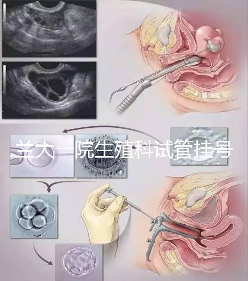 蘭大一院生殖科試管掛號(hào)多少錢別還不造,預(yù)約攻略來(lái)了