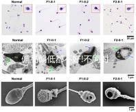偏高偏低都不好!不同時期促卵泡成熟激素正常值一覽