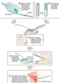 做試管嬰兒最好的醫(yī)院是哪一家？