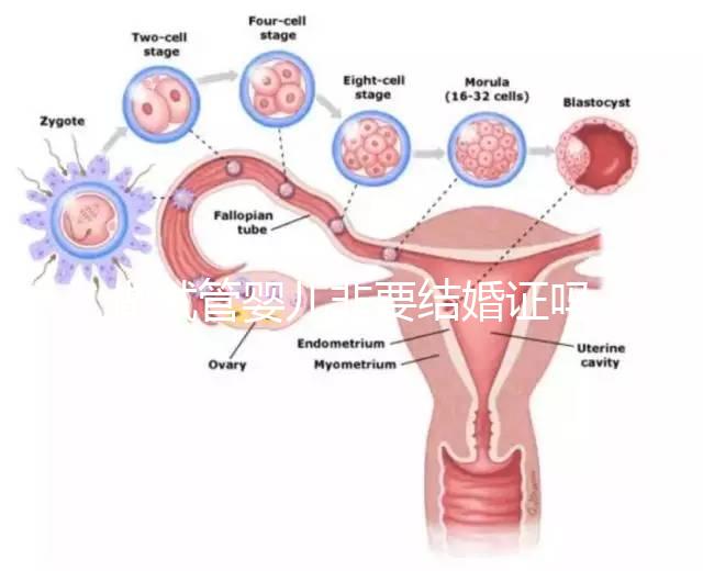 做試管嬰兒非要結(jié)婚證嗎？做試管嬰兒一定需要結(jié)婚證嗎？