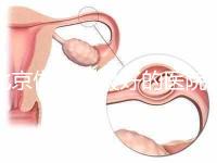 北京做試管最好的醫院是哪