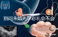 別問未婚先孕彩禮會不會少了，一分不給也不無可能