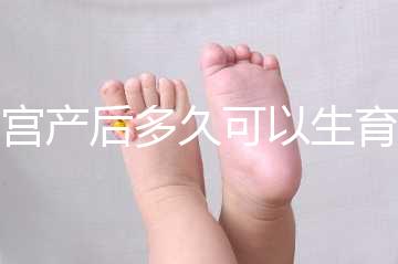 剖宮產后多久可以生育二胎？