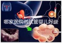 哪家醫院做試管嬰兒好些？