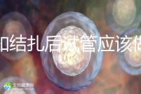 告知結扎后試管應該做什么準備，是否有照片檢查，有答案