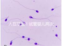 人在孕途!試管嬰兒兩次胎停育,了解這幾招能降低流產(chǎn)風險