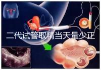 二代試管取精當(dāng)天量少正不正常60s弄清,不造怎么辦速覽