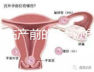 二胎臨產前的7大跡象，出現見紅、陣痛別大意