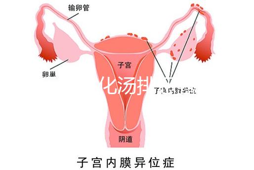 產后喝生化湯排惡露會使寶寶拉肚子？醫生：時間沒用對