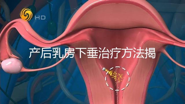 產(chǎn)后乳房下垂治療方法揭秘,按摩手法再好也沒(méi)提前預(yù)防有用