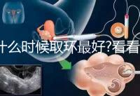 什么時(shí)候取環(huán)最好?看看各地姐妹們有什么經(jīng)驗(yàn)之談