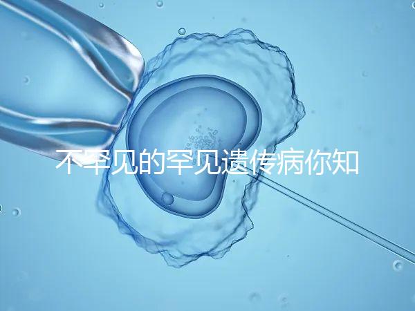 不罕見的罕見遺傳病你知道嗎？帶你認識下特納綜合癥