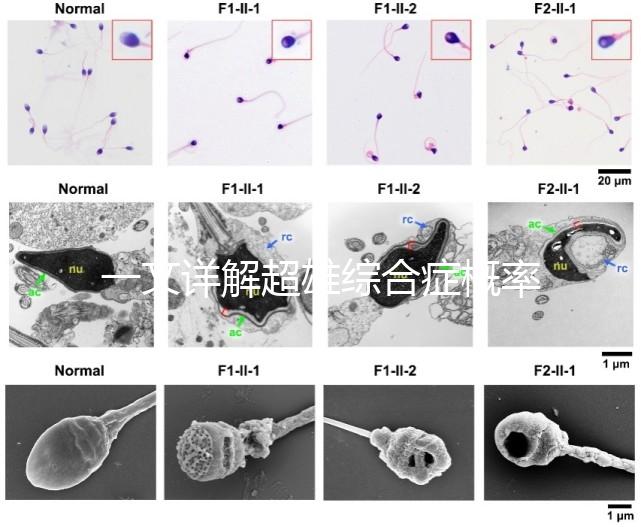 一文詳解超雄綜合癥概率有多大,想造的人多不多看過(guò)來(lái)
