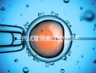 三代試管篩查過(guò)程中會(huì)不會(huì)出現(xiàn)錯(cuò)誤戳，看完流程就知道