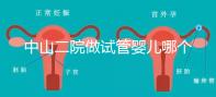 中山二院做試管嬰兒哪個醫生好?附醫院試管成功率