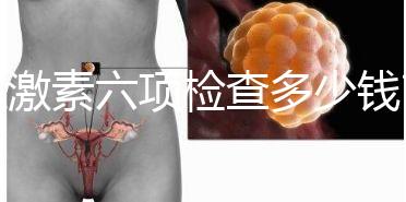 性激素六項(xiàng)檢查多少錢?最終花費(fèi)受這3個(gè)方面影響