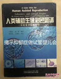 揭示抑郁癥做試管嬰兒會(huì)遺傳給女兒,想避免看這個(gè)