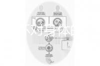 揭秘上環(huán)對(duì)身體的5大壞處，女人別再無知了
