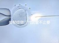 抑郁癥做三代試管不止要基因檢測,這兩大條件也得滿足