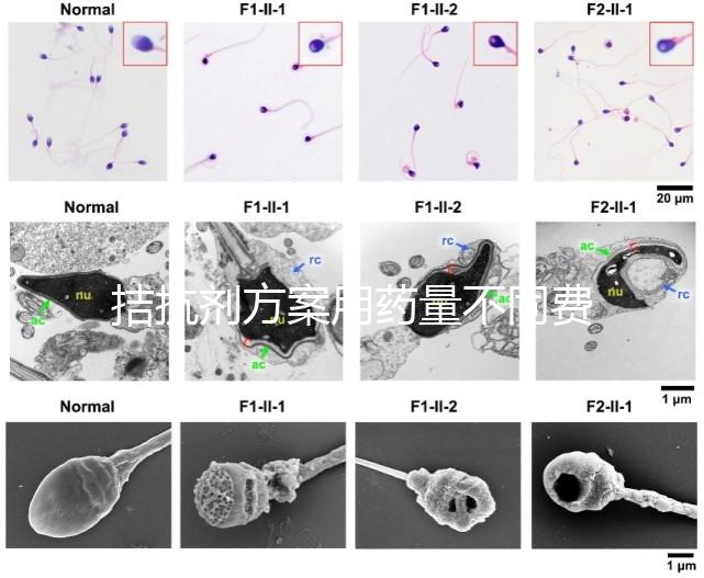 拮抗劑方案用藥量不同費用也不一樣,看看大家都花了多少