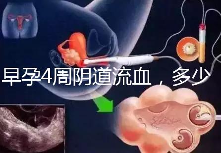早孕4周陰道流血，多少天檢查血hcg或B超更穩妥？