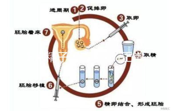 正常精子形態＞4％正常，流產與精子質量不好也有關