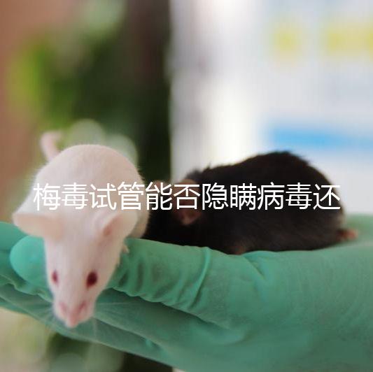 梅毒試管能否隱瞞病毒還沒有建造，備案記錄已經通知