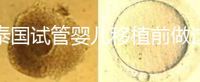泰國試管嬰兒移植前做這3件事能提高成功率，不然會后悔！