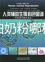水解蛋白奶粉哪種好？口感和消化分析這個品牌出彩