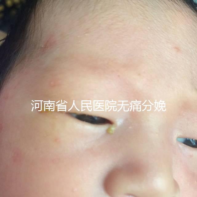 河南省人民醫(yī)院無痛分娩多少錢戳,收費標(biāo)準(zhǔn)60s看懂不踩坑