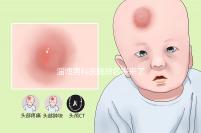 淄博男科醫(yī)院排名表來(lái)了2024年哪個(gè)口碑好?網(wǎng)友怎么說(shuō)?