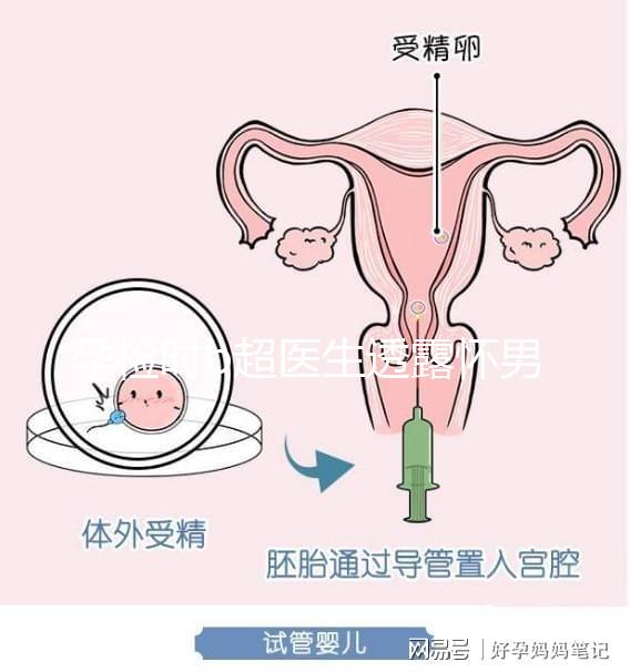 孕檢時(shí)b超醫(yī)生透露懷男寶女寶暗語寶典,一語戳中有心人!