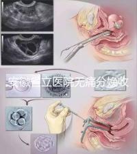 安徽省立醫院無痛分娩收費標準，過來人經歷告訴你怎么樣