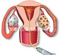 安康市衛(wèi)生計生局：普及優(yōu)生優(yōu)育五項檢查相關(guān)知識