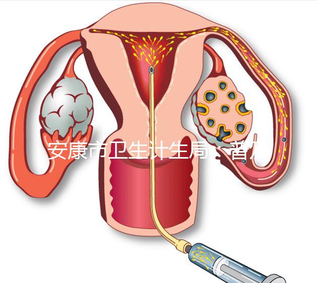 安康市衛(wèi)生計生局:普及優(yōu)生優(yōu)育五項檢查相關(guān)知識