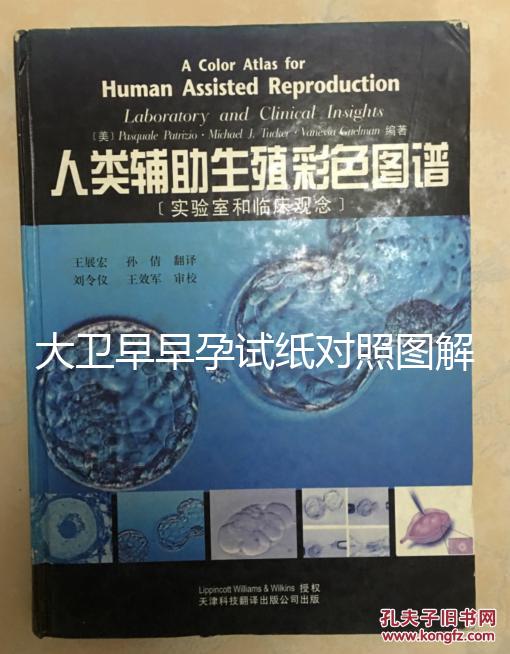 大衛早早孕試紙對照圖解，教你怎么看結果是不是陽性