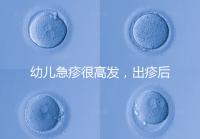 幼兒急疹很高發，出疹后的護理方法及注意事項提前知曉！