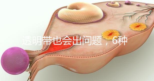 透明帶也會(huì)出問題,6種異常類型形成原因不同