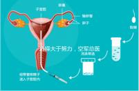 選擇大于努力,空軍總醫(yī)院做試管嬰兒必讀攻略