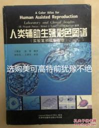 選購美可高特前猶豫不絕,該款羊奶粉品牌質量賣點介紹