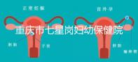 重慶市七星崗婦幼保健院做試管需要多少錢?可以用醫(yī)療保險(xiǎn)嗎?