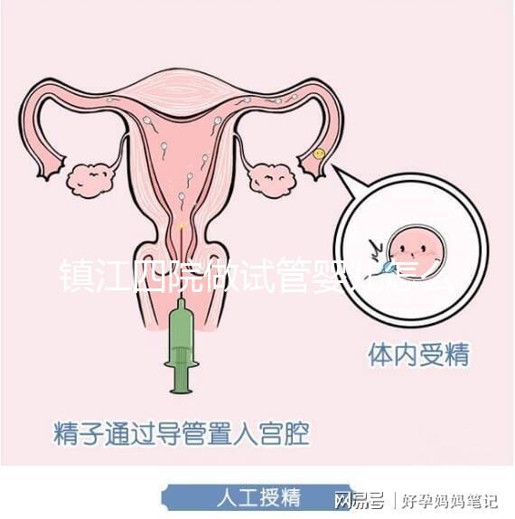 鎮(zhèn)江四院做試管嬰兒怎么樣?具體成功率費(fèi)用介紹