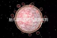 胎兒留級的四大原因找到了!多半和媽媽太懶不運(yùn)動有關(guān)系